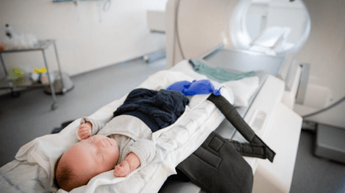 A young baby prepared for medical scan in hospital