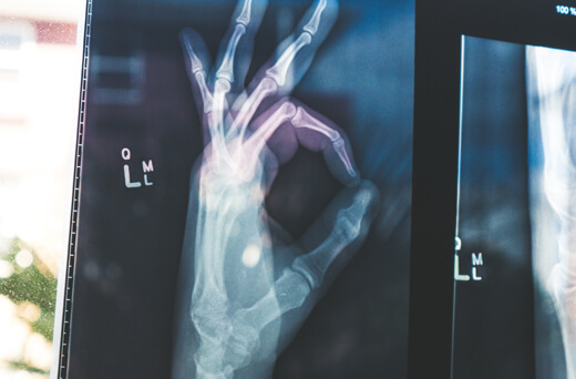 X-ray film of a hand, giving the A-Ok sign